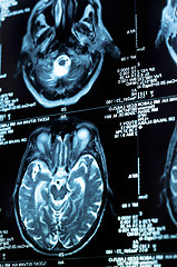 Image showing Ct scan of the human brain tile