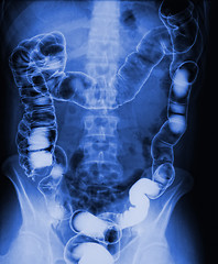 Image showing torso xray