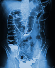 Image showing torso xray