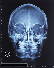 Image showing skull xray