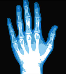 Image showing hand xray