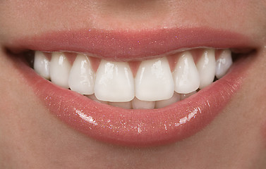 Image showing Teeth