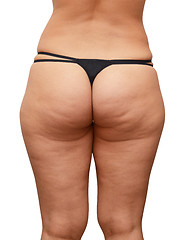 Image showing cellulite buttocks