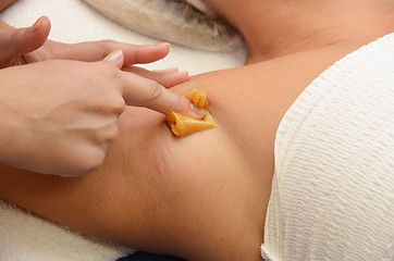 Image showing sugaring epilation