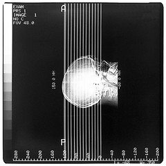 Image showing Medical Xray