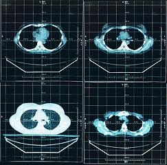 Image showing Tomography of human thorax