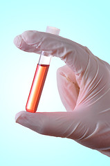 Image showing Blood Sample