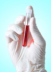 Image showing Blood Sample