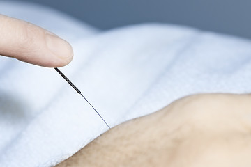 Image showing Acupuncture needle in skin