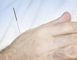 Image showing Acupuncture needle in hand