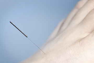 Image showing Acupuncture needle in foot