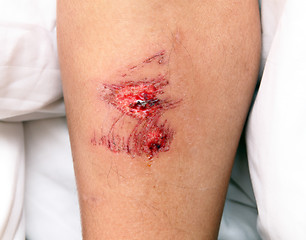 Image showing wound