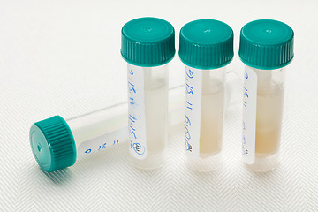 Image showing saliva samples for laboratory test