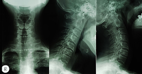 Image showing human body's radiograph