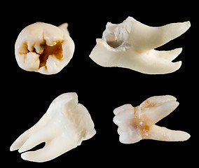 Image showing remote root human teeth 