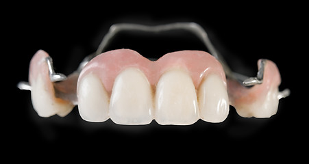 Image showing dental implants