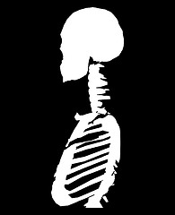 Image showing Bone Cross Section