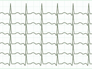 Image showing Heart cardiogram. EPS 8