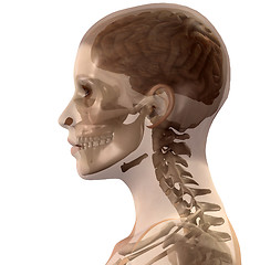 Image showing Head X Ray