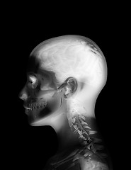 Image showing Head X Ray