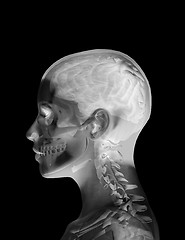 Image showing Head X Ray