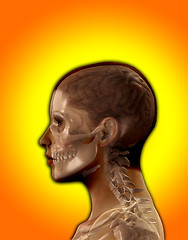 Image showing Head X Ray