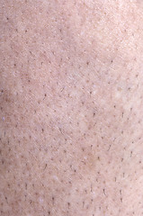 Image showing Unshaved Leg Hair 3