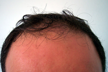 Image showing forehead