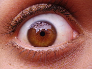 Image showing Eye