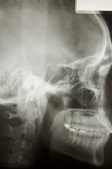 Image showing Skull X-Ray