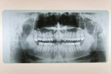 Image showing Skull X-Ray