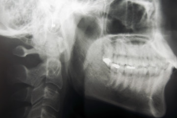 Image showing Skull X-Ray