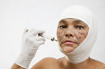 Image showing Plastic surgery