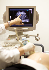 Image showing medical examining by ultrasonic scan