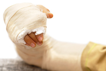 Image showing Broken arm