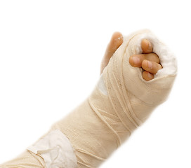 Image showing Broken arm