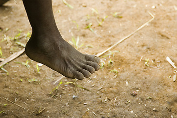 Image showing Foot