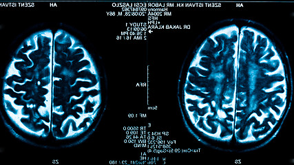 Image showing Closeup of a computer axial tomography scan (CAT scan)