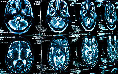 Image showing Closeup of a computer axial tomography scan (CAT scan)