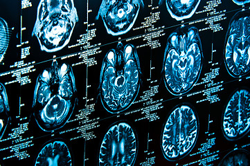 Image showing Closeup of a computer axial tomography scan (CAT scan)