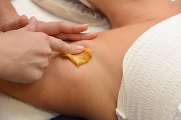 Image showing sugaring epilation