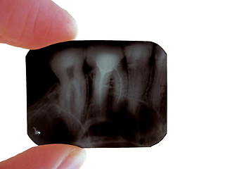 Image showing roentgenogram of teeth