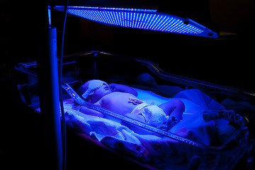 Image showing Baby with Phototherapy