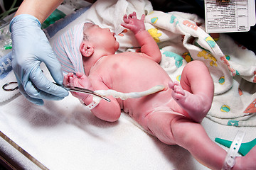 Image showing Newborn cute infant baby with umbilical cord