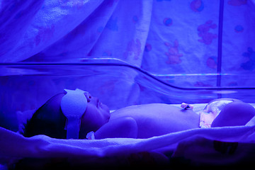 Image showing Baby under Phototherapy