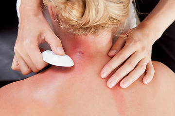 Image showing Woman Receiving GuaSha Treatment on Neck