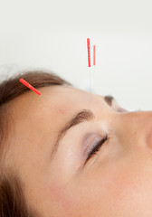 Image showing Facial Acupuncture