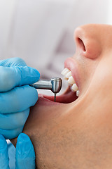 Image showing Drill Dentist