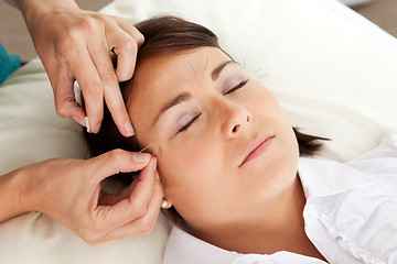 Image showing Acupuncture Therapist Placing Needle in Face