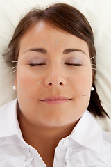 Image showing Facial Beauty Acupuncture Treatment